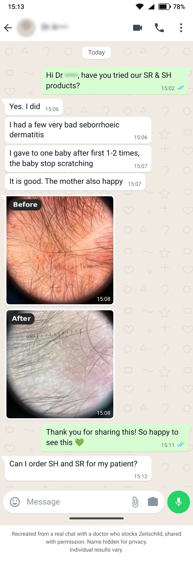WhatsApp chat with a doctor who stocks Zeitschild about SR and SH for a baby's scalp, with scalp photos. Disclosure below the chat.
